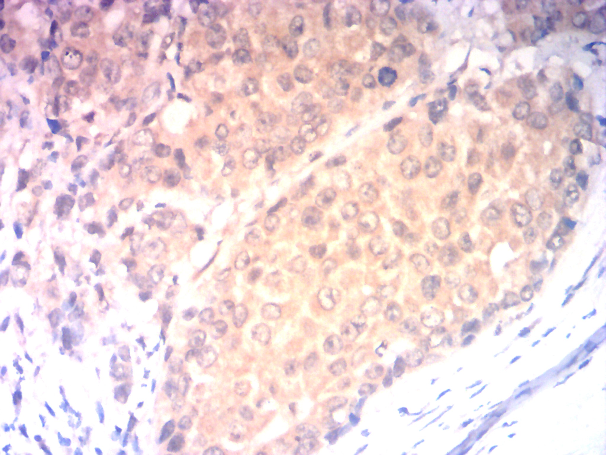IHC
